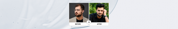 Hairfall ho raha hai?