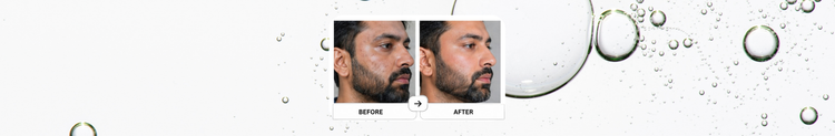Have Dark spots and Uneven Skin tone?