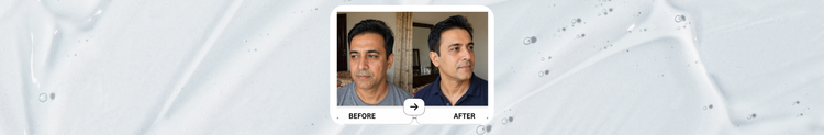 Aging signs like wrinkles and Unfirm skin?